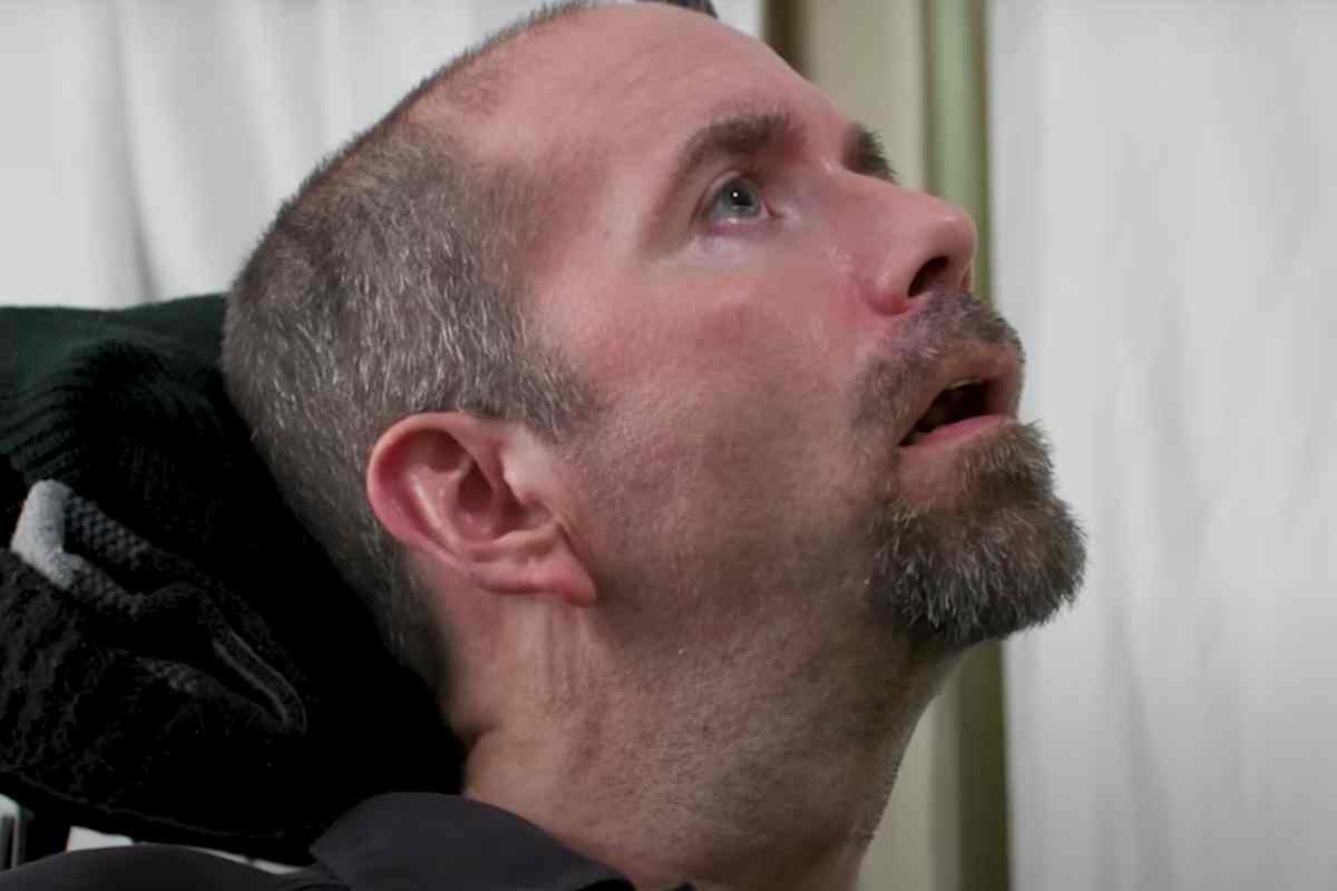 Casey Harrell prima del nuovo impianto cerebrale installato